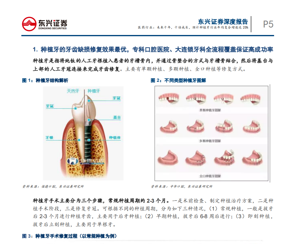 未來(lái)十年，十倍成長(cháng)，預 計種植牙行業(yè)年均復合增速達25%——東興證券